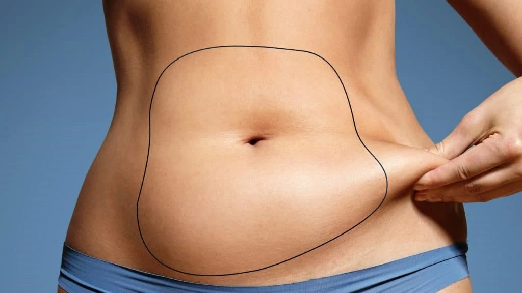 Abdominal-side-lipomatics