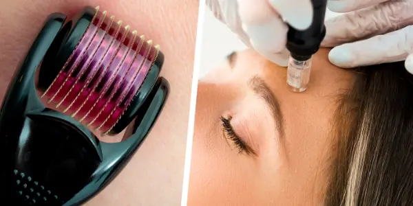 Tattoo-removal-microneedling